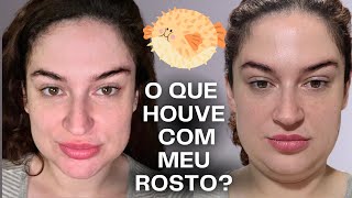 O QUE HOUVE COM MEU ROSTO? + Skincare Dia! | Duda Fernandes