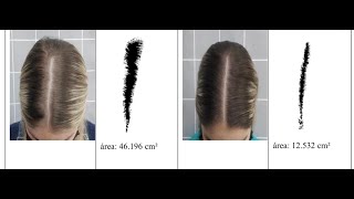 TUDO SOBRE QUEDA DE CABELO - Vanessa Machadoa