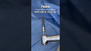 IMPLANTE DENTAL