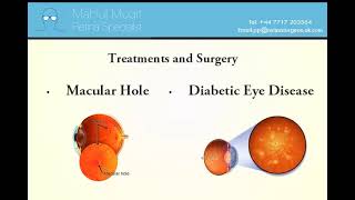 Retina Specialist  - Mr Mahi Muqit PhD FRCOphth